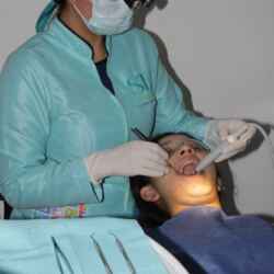 DENTISTA-XALAPA-CARIES